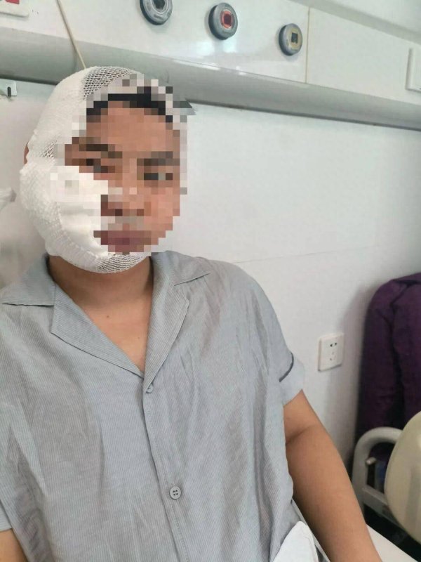男子在海洋王国游玩被3米长鲨鱼咬伤头脸，工作人员：涉事项目已停业整顿